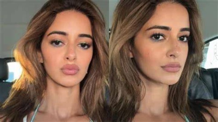 Alanna Panday Plastic Surgery Before And After Photo